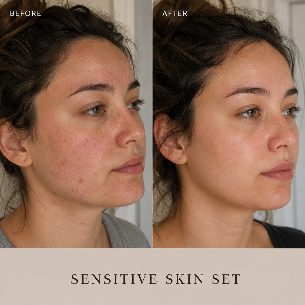 Sensitive Skin Ritual - Natural Skincare Set for Reactive Skin